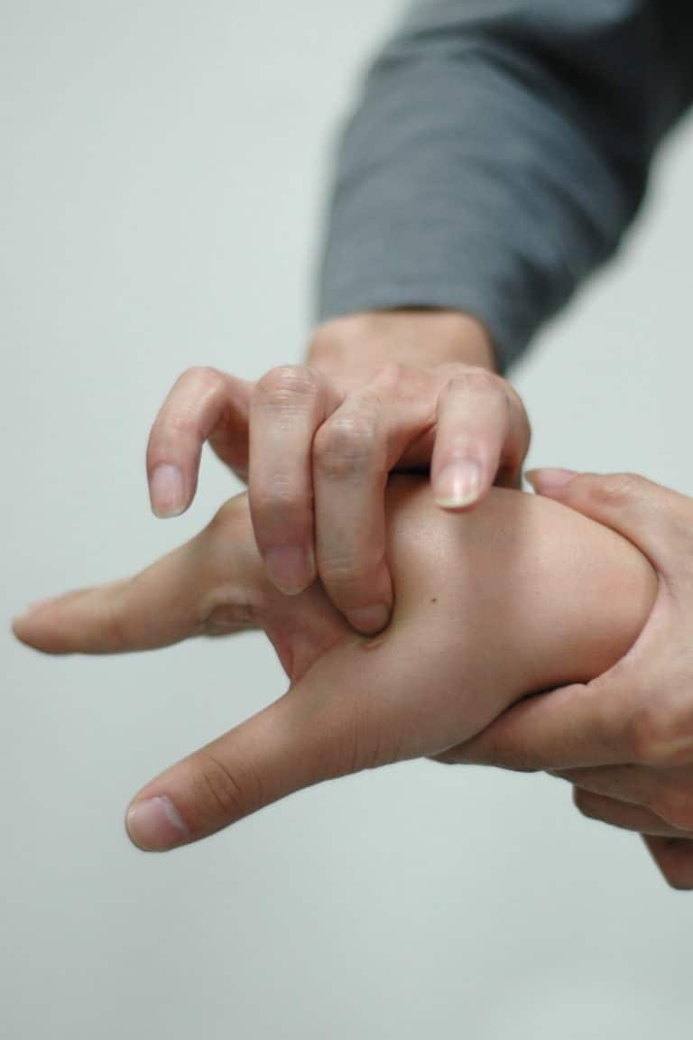 Acupuncture