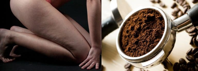 cellulite marc de café