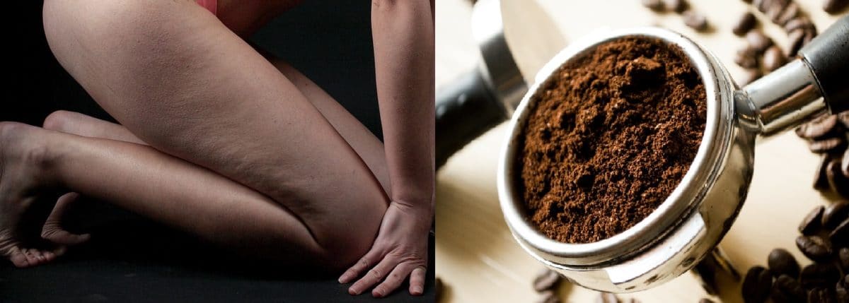 cellulite marc de café