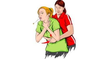 La méthode d'Heimlich