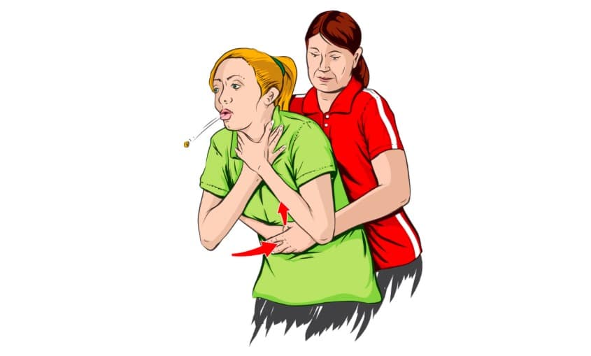 La méthode d'Heimlich
