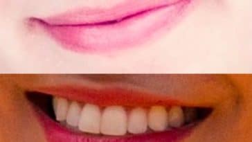 sourire bouche dents