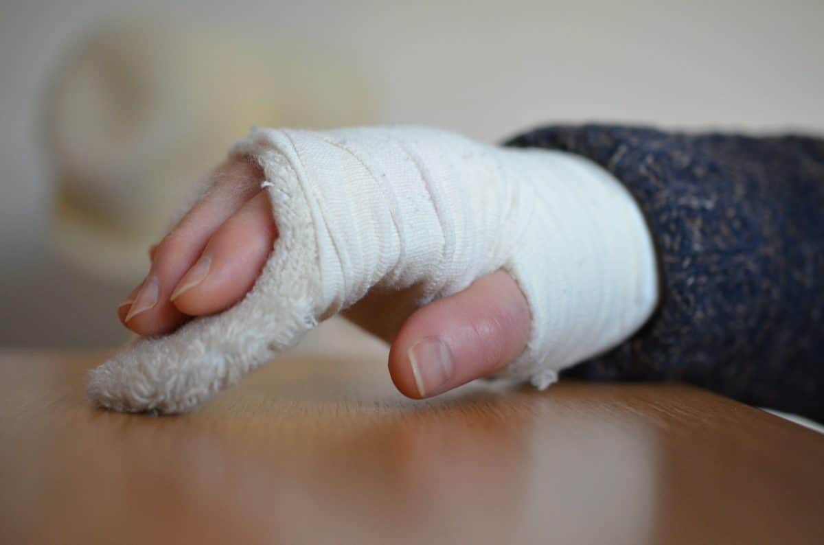 fracture - main