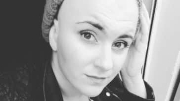 angélique alopécie