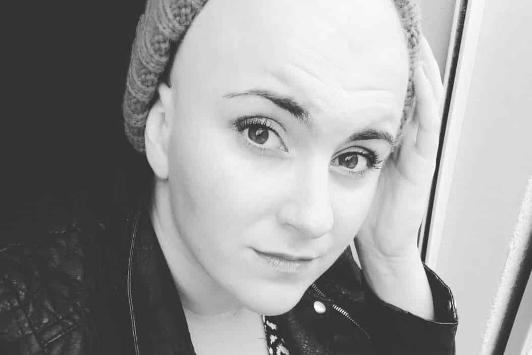 angélique alopécie