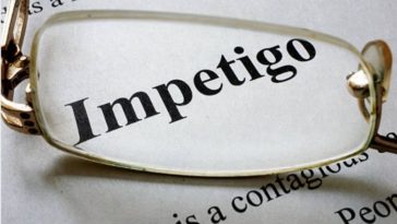 impétigo designer491 iStock