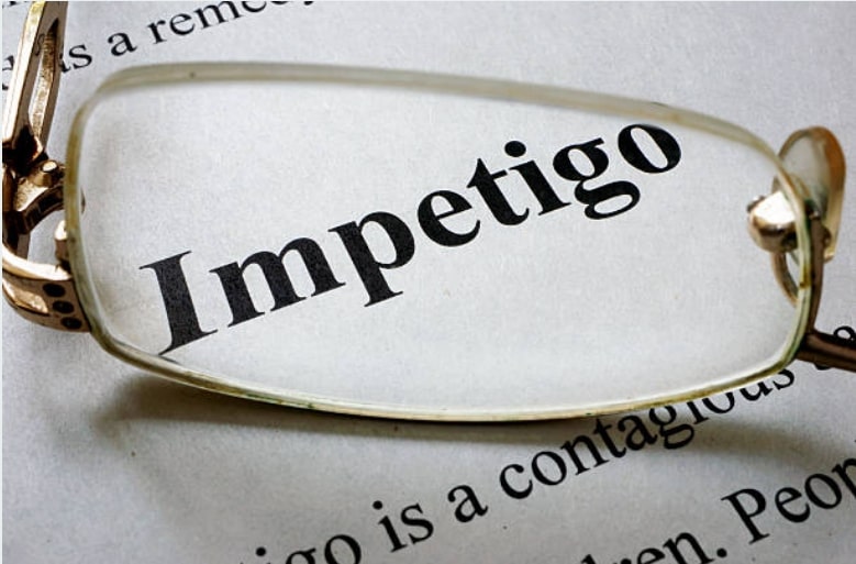 impétigo designer491 iStock