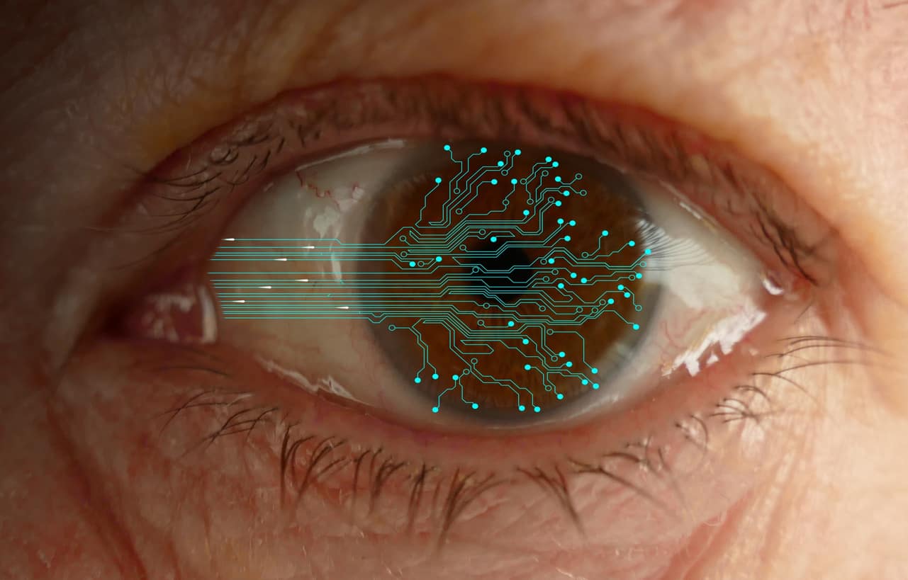neurolink-implant-cerveau-elon-musk