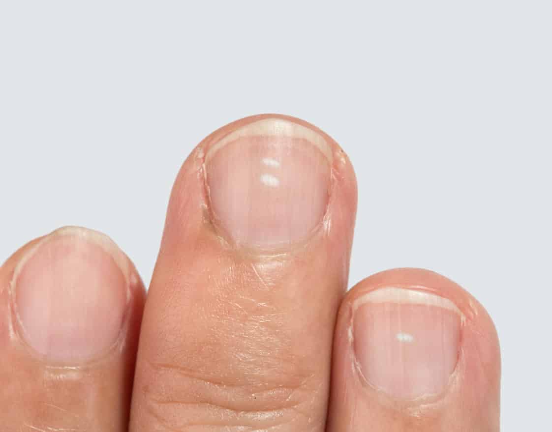 Ongles 8 Choses Surprenantes Conna tre